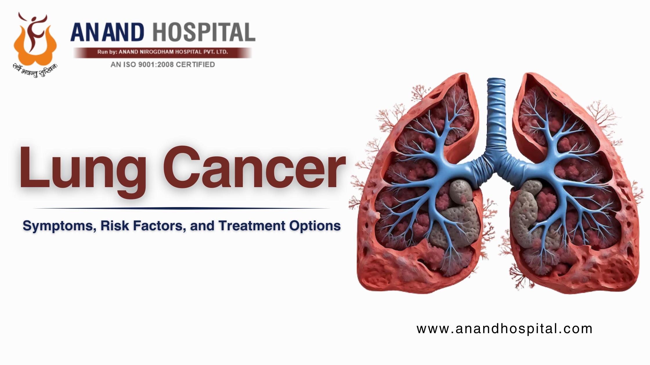 Lung Cancer