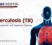 Tuberculosis TB