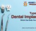 Types of Dental Implants